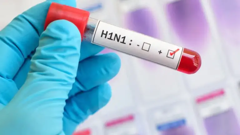जांजगीर-चांपा में तेजी से फैल रहा स्वाइन फ्लू! युवक की मौत के बाद H1N1 रिपोर्ट पॉजिटिव, जिले में अब तक 6 संदिग्ध मरीज webp 56 768x432